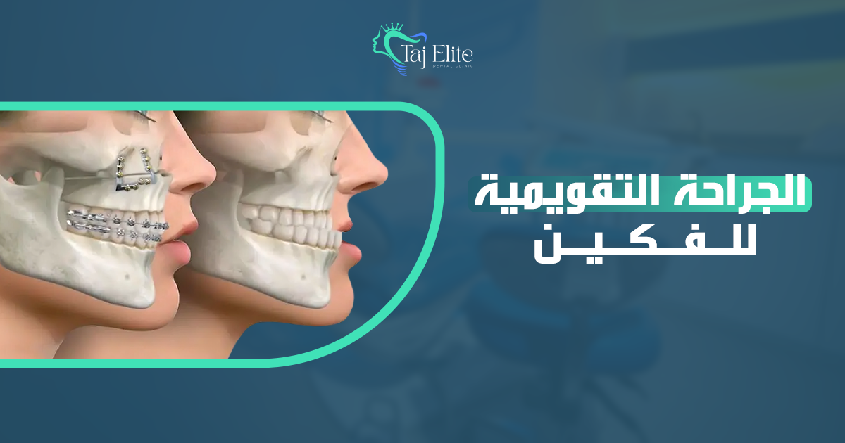 الجراحة التقويمية للفكين