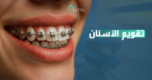 تقويم الأسنان