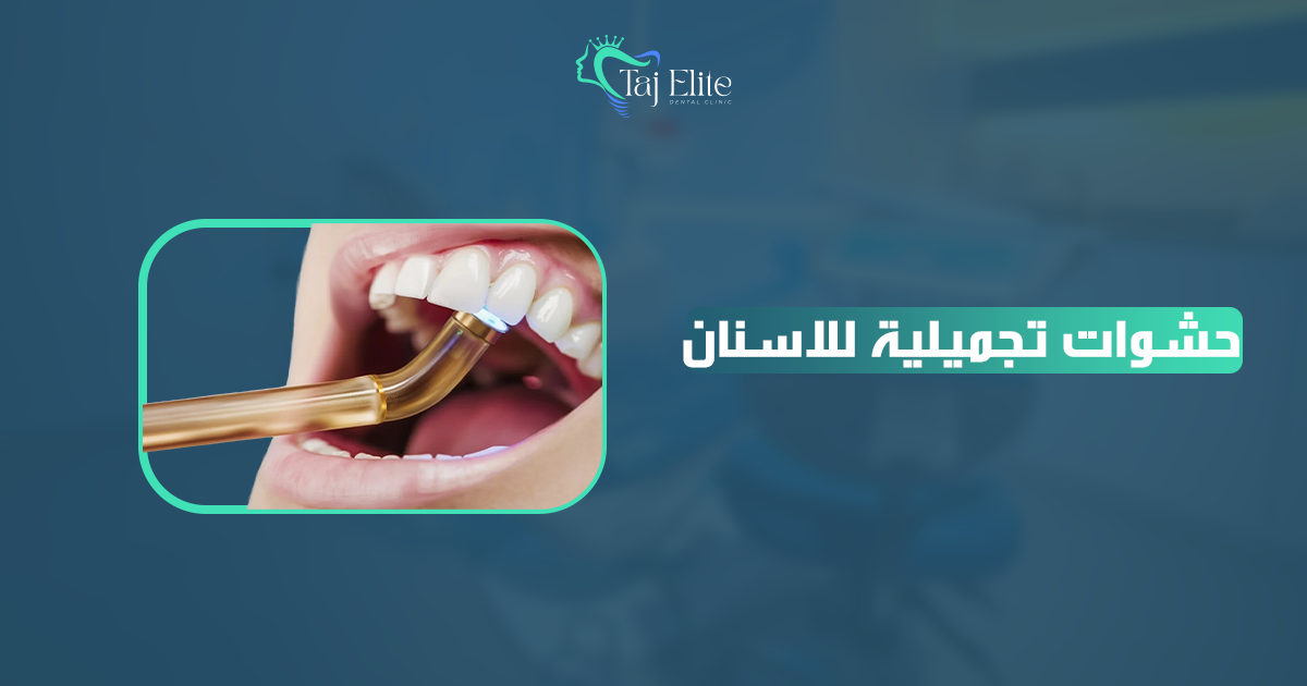 حشوات تجميلية